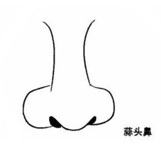 面相解析蒜头鼻的人面相如何 长有蒜头鼻的人命运怎样