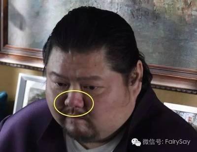 面相解析额头有竖纹 额头有皱纹的人分析