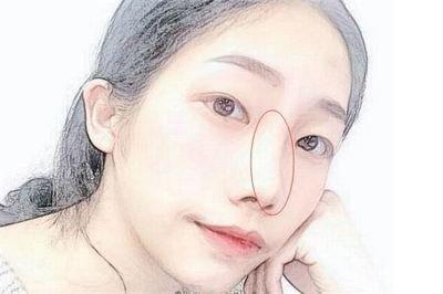 面相解读“歪鼻子”的命理意义 鼻子歪会有哪些影响
