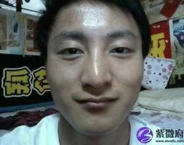 面相解读“歪鼻子”的命理意义 鼻子歪会有哪些影响