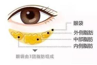 面相详解卧蚕眼是什么样的 卧蚕眼的人命运如何
