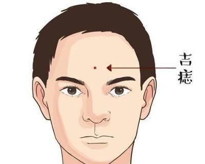 面相痣详细解析大全 面部长痣是好还是不好