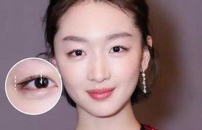 面相鱼尾纹看一个人的命运 眼角长鱼尾纹说明什么