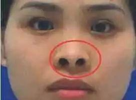 面相鼻子很尖的人 鼻子尖的人运势如何