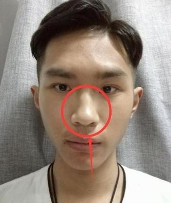 面相鼻孔朝天意味着什么 鼻孔朝天是好还是不好