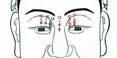面部哪里长痣有好的象征含义 脸上哪些地方长痣好