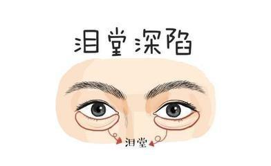 面相看婚姻难顺的女人 什么样子的女人婚姻不好