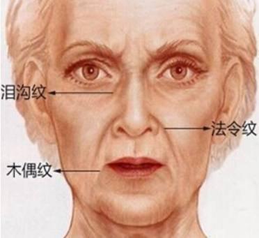 面相看法令纹命运如何 怎么看法令纹面相