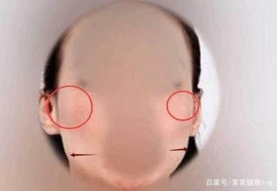 面相看清心胸狭窄的小人 小人一般都长什么样子