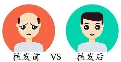 额头与事业 额头生长决定你事业的发展
