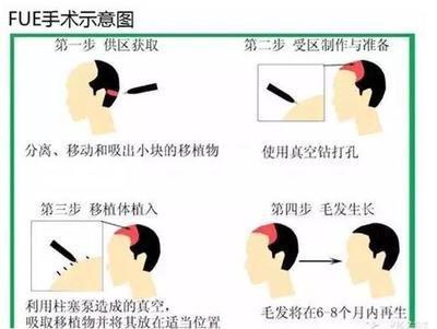 额头与事业 额头生长决定你事业的发展