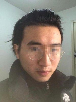 额头凹陷的面相预示着什么 谈谈额头凹陷的人性格