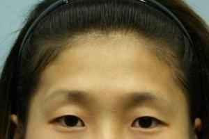 额头凹陷面相命运怎么样 额头凹陷的人性格好不好