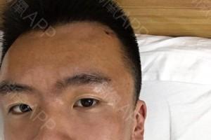 额头凹陷面相的男人好不好 男人额头凹陷代表着什么