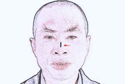 面相看财运之会破财的痣都长在哪里解析