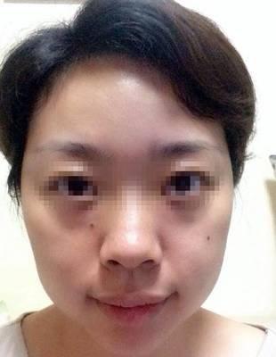 额头小的人运势好吗 额头小意味着什么
