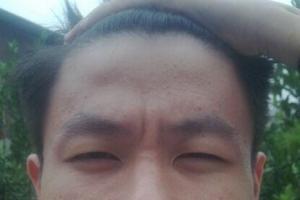额头悬针纹的人面相怎么样 额头有悬针纹好不好