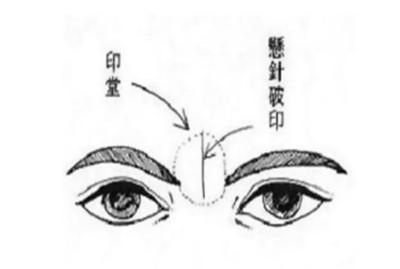 额头悬针纹面相图解大全 额头有悬针纹有哪些影响