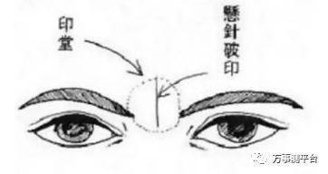 额头有悬针纹男人的面相 男人额头长悬针纹好吗