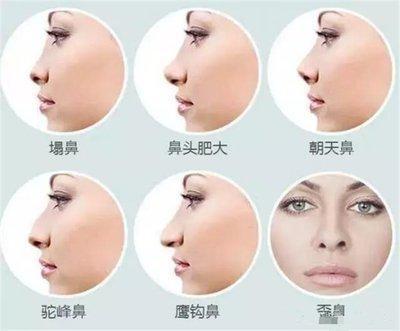 面相看鼻孔朝天意味着什么 鼻孔朝天面相详细分析