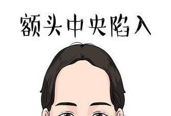 额头窄的女人命运如何 女人额头窄到底好不好