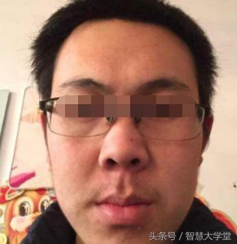 额头窄的面相命运好不好 额头窄的人性格好吗
