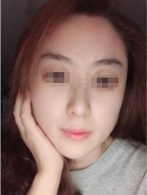 颧骨饱满的人性格如何 颧骨饱满代表着什么
