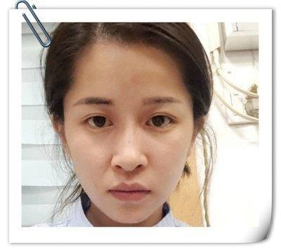 驼峰鼻面相详解 驼峰鼻的女人性格如何