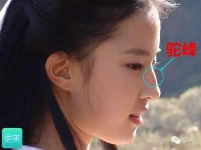 驼峰鼻型的人命运坎坷 驼峰鼻的人命运真的不好吗