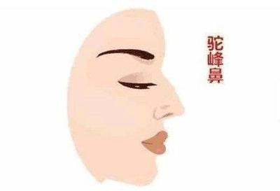 驼峰鼻子面相好不好 驼峰鼻意味着什么