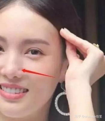 鼻子上有疤痕面相 鼻子有疤痕的女人命运