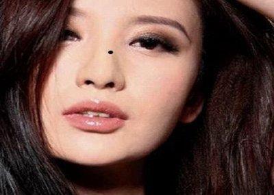 鼻子上长痣好不好运势如何 鼻子长痣好吗