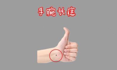 鼻子上长痣运势怎么样 鼻子长痣是不好的吗