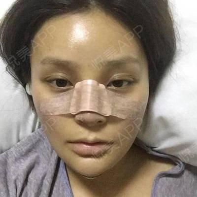 鼻子塌的女人有福气吗 女人鼻子塌意味着什么