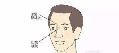 鱼尾纹面相分析 长有鱼尾纹说明了什么