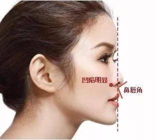 鼻子大是怎样一种体验 鼻子大是不好吗