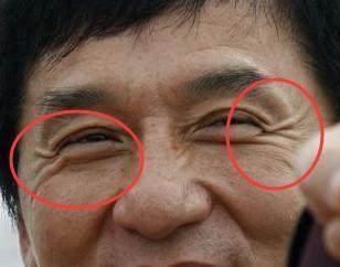 鱼尾纹面相有哪些具体的含义 长有鱼尾纹说明什么