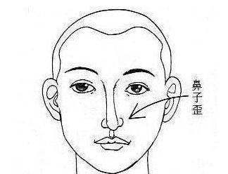 鼻子歪的人面相如何 歪鼻子的人到底好不好