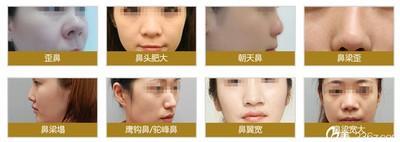 鼻子歪的男人命运如何 男人鼻梁歪好不好