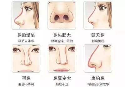 鼻子歪的面相好不好 鼻子歪说明了什么