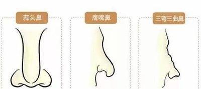 鼻子看相图解蒜头鼻是什么样的 长有蒜头鼻好不好