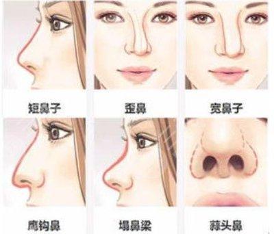 鼻子短的人命好不好 鼻子短代表着什么