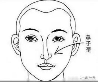 鼻子长歪了面相 鼻子歪的人命运如何
