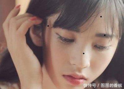 鼻尖有痣竟然是这种寓意 鼻尖有痣需要点掉吗