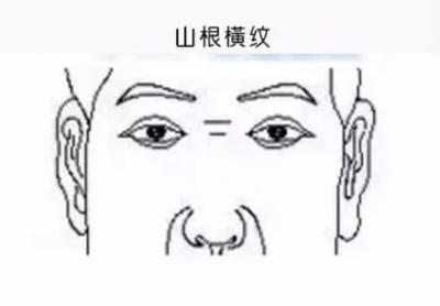 鼻梁上有横纹的面相代表的寓意是什么