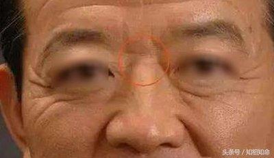 鼻梁上有横纹面相代表的寓意 鼻梁长有横纹好吗