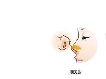 鼻梁塌面相是什么说法 解决鼻梁塌的人命运
