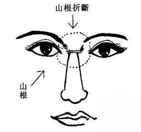 鼻梁有横纹的人面相 鼻梁长有横纹说明了什么