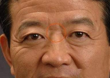 鼻梁有横纹的人面相 鼻梁长有横纹说明了什么