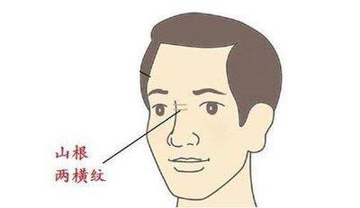 鼻梁有横纹面相好不好 鼻梁出现横纹意味着什么